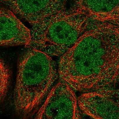 Immunocytochemistry/Immunofluorescence: TSPAN15 Antibody [NBP1-92540] - Staining of human cell line A-431 shows localization to nucleoplasm & cytosol. Antibody staining is shown in green.
