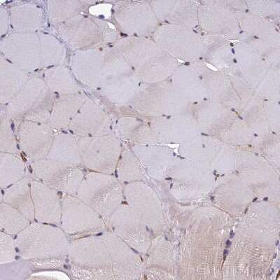 Immunohistochemistry-Paraffin: TSPAN15 Antibody [NBP1-92540] - Staining of human skeletal muscle shows weak positivity in plasma membrane in myocytes.