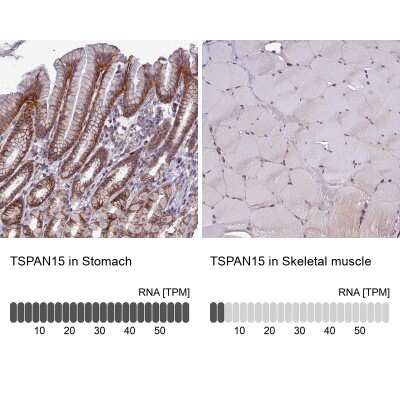 Immunohistochemistry-Paraffin: TSPAN15 Antibody [NBP1-92540] - Staining in human stomach and skeletal muscle tissues . Corresponding TSPAN15 RNA-seq data are presented for the same tissues.