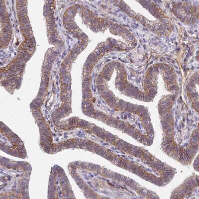 Immunohistochemistry-Paraffin: TSPAN15 Antibody [NBP1-92540] - Staining of human Fallopian tube shows moderate membranous positivity in glandular cells.