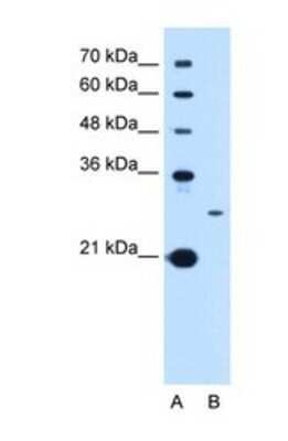 Western Blot: TSPAN15 Antibody [NBP1-69340] - This Anti-TSPAN15 antibody was used in Western Blot of HepG2 tissue lysate at a concentration of 1ug/ml.