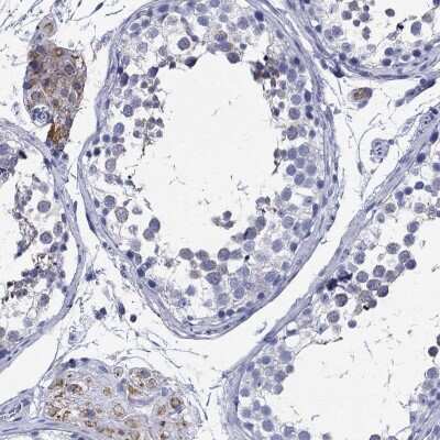 Immunohistochemistry-Paraffin: TSPAN16 Antibody [NBP3-16969] - Staining of human testis shows high expression.
