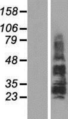 Western Blot: TSPAN18 Overexpression Lysate (Adult Normal) [NBP2-09962] Left-Empty vector transfected control cell lysate (HEK293 cell lysate); Right -Over-expression Lysate for TSPAN18.