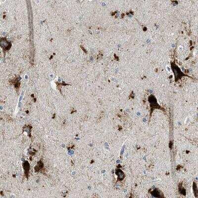 Immunohistochemistry-Paraffin TSPAN3 Antibody - BSA Free