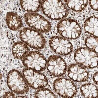 Immunohistochemistry-Paraffin: TSPAN32/TSSC6 Antibody [NBP1-87282] - Staining of human rectum shows strong nuclear and cytoplasmic positivity in glandular cells.