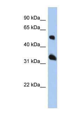 Western Blot: TSPAN33 Antibody [NBP1-91465] - HepG2 cell lysate, concentration 0.2-1 ug/ml.