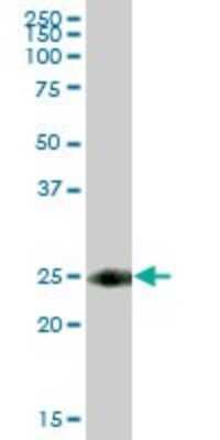 Western Blot: TSPAN8/TM4SF3 Antibody [H00007103-B01P] - Analysis of TSPAN8 expression in human colon.