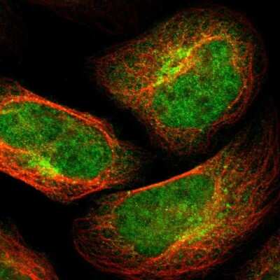 Immunocytochemistry/Immunofluorescence: TSPAN9 Antibody [NBP1-81003] - Staining of human cell line U-2 OS shows localization to nucleoplasm, cytosol & the Golgi apparatus.