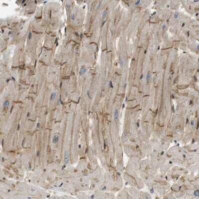 Immunohistochemistry-Paraffin: TSPAN9 Antibody [NBP1-81003] - Staining of human heart muscle shows moderate positivity in intercalated discs.