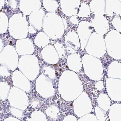 Immunohistochemistry-Paraffin TSPEAR Antibody