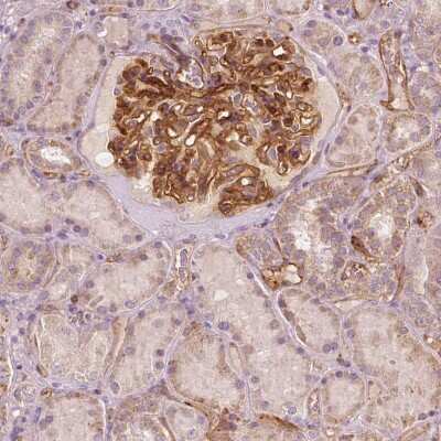 Immunohistochemistry: TSPO2 Antibody [NBP2-49501] - Staining of human kidney shows strong membranous positivity in cells in glomeruli.