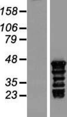 Western Blot: TSPY3 Overexpression Lysate (Adult Normal) [NBL1-12626] Left-Empty vector transfected control cell lysate (HEK293 cell lysate); Right -Over-expression Lysate for TSPY3.