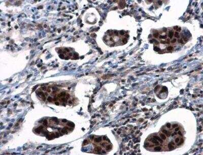 Immunohistochemistry-Paraffin TSPYL1 Antibody - BSA Free