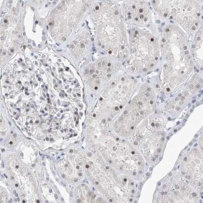 Immunohistochemistry-Paraffin: TSPYL1 Antibody [NBP1-86898] - Staining of human kidney shows nuclear positivity in cells in tubules.