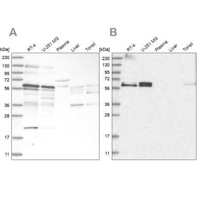 Western Blot: TSPYL1 Antibody [NBP1-86898] - Analysis using Anti-TSPYL1 antibody NBP1-86898 (A) shows similar pattern to independent antibody NBP2-38191 (B).