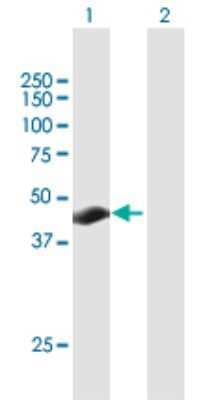 Western Blot: TSPYL3 Antibody [H00128854-B01P] - Analysis of TSPYL3 expression in transfected 293T cell line by TSPYL3 polyclonal antibody.  Lane 1: TSPYL3 transfected lysate(39.05 KDa). Lane 2: Non-transfected lysate.