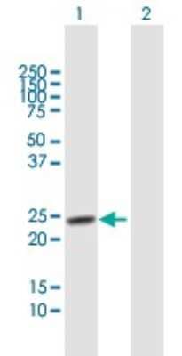 Western Blot TSPYL4 Antibody - Azide and BSA Free