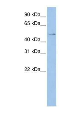 Western Blot: TSPYL4 Antibody [NBP1-56289] - Jurkat cell lysate, concentration 0.2-1 ug/ml.