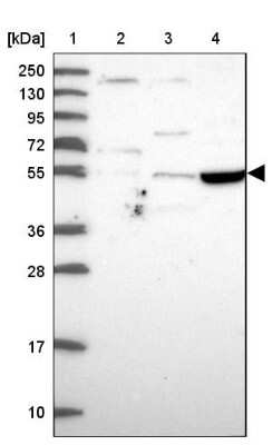 Western Blot TSPYL4 Antibody - BSA Free