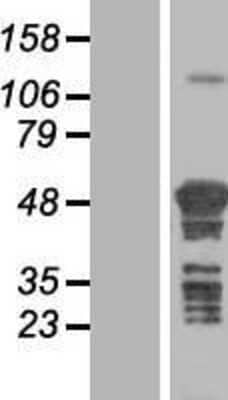 Western Blot TSPYL4 Overexpression Lysate