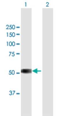 Western Blot: TSPYL6 Antibody [H00388951-B01P] - Analysis of TSPYL6 expression in transfected 293T cell line by TSPYL6 polyclonal antibody.  Lane 1: TSPYL6 transfected lysate(45.1 KDa). Lane 2: Non-transfected lysate.