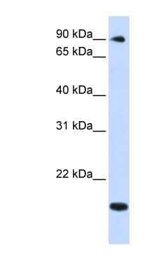 Western Blot: TSR1 Antibody [NBP1-55349] - Titration: 0.2-1 ug/ml, Positive Control: Human heart.