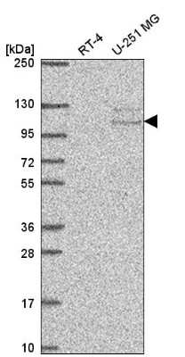 Western Blot: TSR1 Antibody [NBP2-58300] - Western blot analysis in human cell line RT-4 and human cell line U-251 MG.