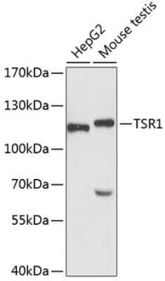 Western Blot: TSR1 Antibody [NBP2-93282] - Analysis of extracts of various cell lines, using TSR1 at 1:3000 dilution. Secondary antibody: HRP Goat Anti-Rabbit IgG (H+L) at 1:10000 dilution. Lysates/proteins: 25ug per lane. Blocking buffer: 3% nonfat dry milk in TBST. Detection: ECL Basic Kit . Exposure time: 90s.