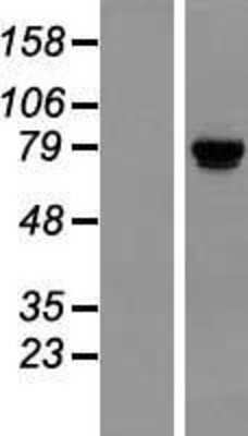 Western Blot: TSR1 Overexpression Lysate (Adult Normal) [NBL1-17389] Left-Empty vector transfected control cell lysate (HEK293 cell lysate); Right -Over-expression Lysate for TSR1.