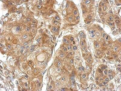 Immunohistochemistry-Paraffin: TSR2 Antibody [NBP2-20750] - Immunohistochemical analysis of paraffin-embedded Cal27 xenograft, using antibody at 1:500 dilution.