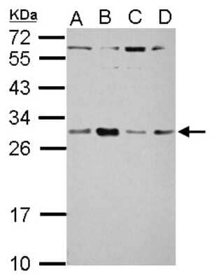 Western Blot: TSR2 Antibody [NBP2-20750] - Sample (30 ug of whole cell lysate) A: A549 B: H1299 C: HCT116 D: MCF-7 12% SDS PAGE gel, diluted at 1:2000.