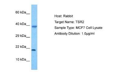 Western Blot: TSR2 Antibody [NBP2-86017] - Host: Rabbit. Target Name: TSR2. Sample Tissue: Human MCF7 Whole Cell lysates. Antibody Dilution: 1ug/ml