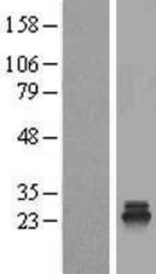 Western Blot: TSR2 Overexpression Lysate (Adult Normal) [NBL1-17390] Left-Empty vector transfected control cell lysate (HEK293 cell lysate); Right -Over-expression Lysate for TSR2.