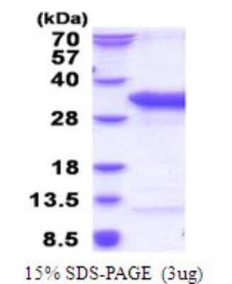 SDS-Page: TSR2 Recombinant Protein [NBP2-51821] - 15% SDS Page (3 ug)