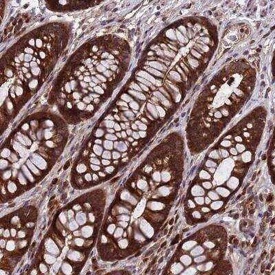Immunohistochemistry-Paraffin TSR3 Antibody - BSA Free