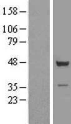 Western Blot: TSSC1 Overexpression Lysate (Adult Normal) [NBL1-17391] Left-Empty vector transfected control cell lysate (HEK293 cell lysate); Right -Over-expression Lysate for TSSC1.