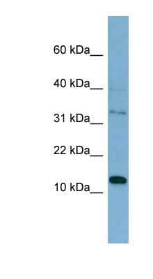 Western Blot: TSSC3 Antibody [NBP1-59088] - HT1080 cell lysate, concentration 0.2-1 ug/ml.