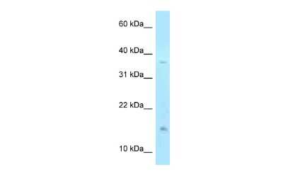 Western Blot: TSSC3 Antibody [NBP2-82367] - WB Suggested Anti-PHLDA2 Antibody. Titration: 1.0 ug/ml. Positive Control: 293T Whole Cell