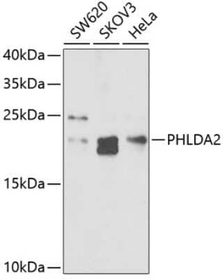 Western Blot: TSSC3 Antibody [NBP2-93728] - Analysis of extracts of various cell lines, using TSSC3 at 1:1000 dilution. Secondary antibody: HRP Goat Anti-Rabbit IgG (H+L) at 1:10000 dilution. Lysates/proteins: 25ug per lane. Blocking buffer: 3% nonfat dry milk in TBST. Detection: ECL Basic Kit . Exposure time: 60s.