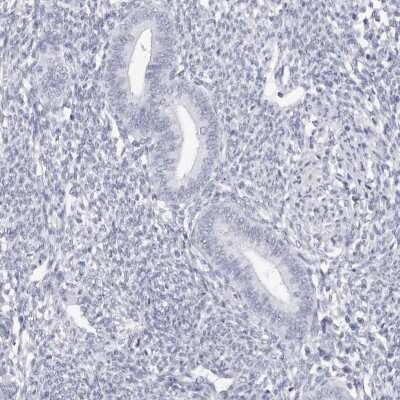 Immunohistochemistry-Paraffin TSSK1 Antibody