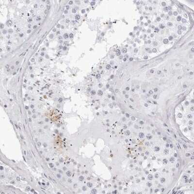 Immunohistochemistry-Paraffin TSSK1 Antibody