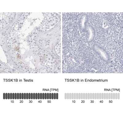 Immunohistochemistry-Paraffin TSSK1 Antibody