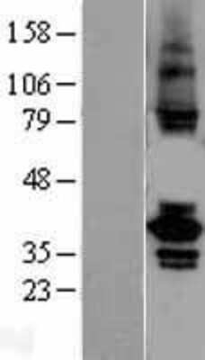 Western Blot TSSK2 Overexpression Lysate