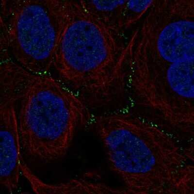 Immunocytochemistry/ Immunofluorescence TSSK4 Antibody