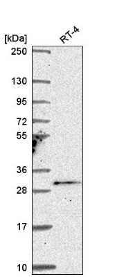 Western Blot TSSK4 Antibody