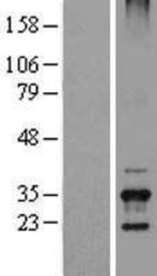 Western Blot: TSSK6 Overexpression Lysate (Adult Normal) [NBL1-17395] Left-Empty vector transfected control cell lysate (HEK293 cell lysate); Right -Over-expression Lysate for TSSK6.