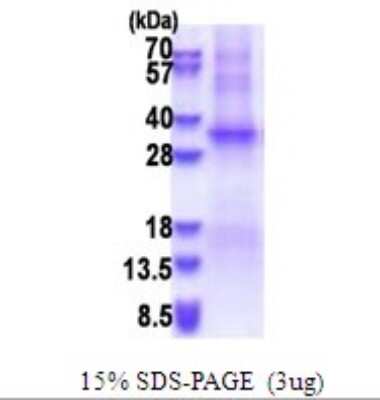 SDS-PAGE Recombinant Human TSSK6 His Protein