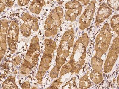 Immunohistochemistry-Paraffin: TSTD1 Antibody [NBP2-98187] - Immunochemical staining of human TSTD1 in human stomach with rabbit polyclonal antibody at 1:2000 dilution, formalin-fixed paraffin embedded sections.