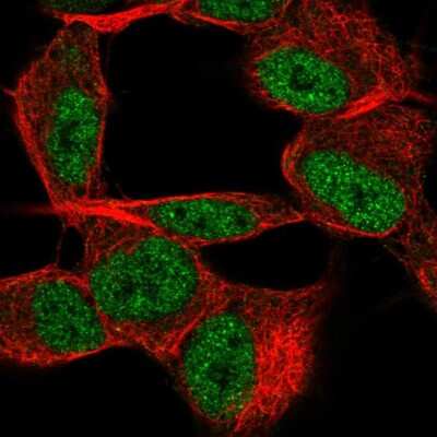 Immunocytochemistry/Immunofluorescence: TSTD2 Antibody [NBP2-57276] - Staining of human cell line SH-SY5Y shows localization to nucleoplasm.