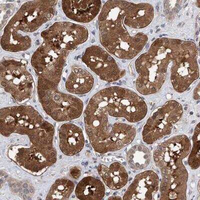 Immunohistochemistry: TSTD2 Antibody [NBP1-86696] - Staining of human kidney shows strong cytoplasmic and nuclear positivity in proximal tubules.